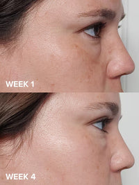 Paula’s Choice 2% BHA  Liquid Exfoliant