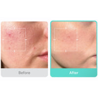 Medicube Azelaic Acid 16 BB Calming Serum