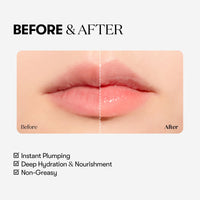 VT COSMETICS Reedle Shot Lip Plumper – Beginner
