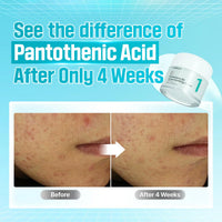 Numbuzin No.1 Pantothenis B5 Cream Active Soothing Cream