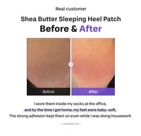 Baren Shea Butter Sleeping Heal Patch