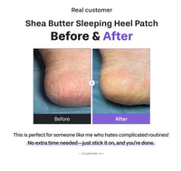Baren Shea Butter Sleeping Heal Patch