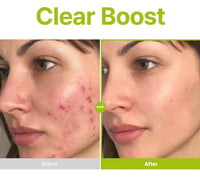 PURITO SEOUL Azelaic Acid 10 Kojic Tea Tree Serum
