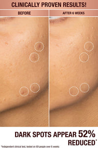 Charlotte Tilbury Dark Spot Correcting Radiance Serum (sample size)