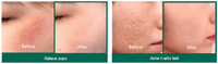 SOME BY MI Snail Truecica Miracle Repair Serum
