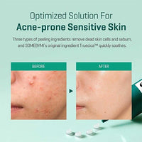 SOME BY MI Super Miracle Spot All Kill Cream