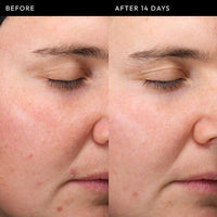 The INKEY List Exosome Hydro-Glow Complex Serum (sample size)